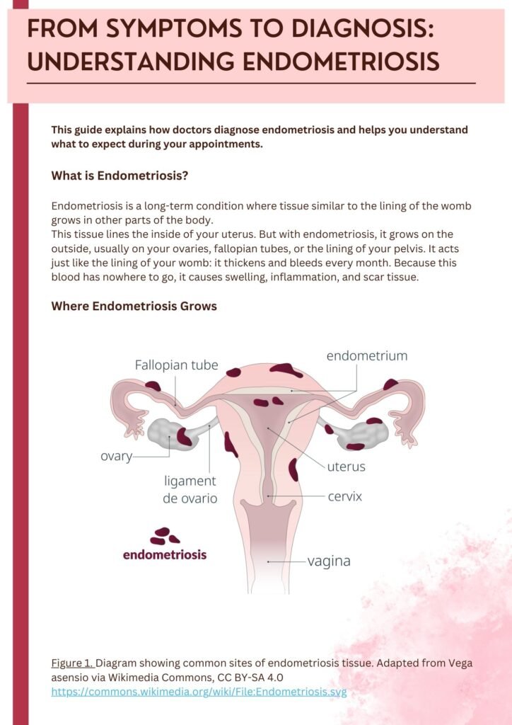 Cover page of an endometriosis guide titled "from Symptoms to Diagnosis", featuring a medical diagram of the female reproductive system showing common endometriosis sites.